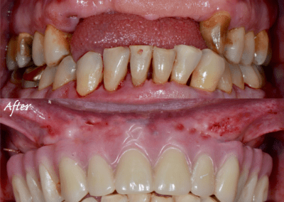 Key West Dentist Patient Transformation Photo